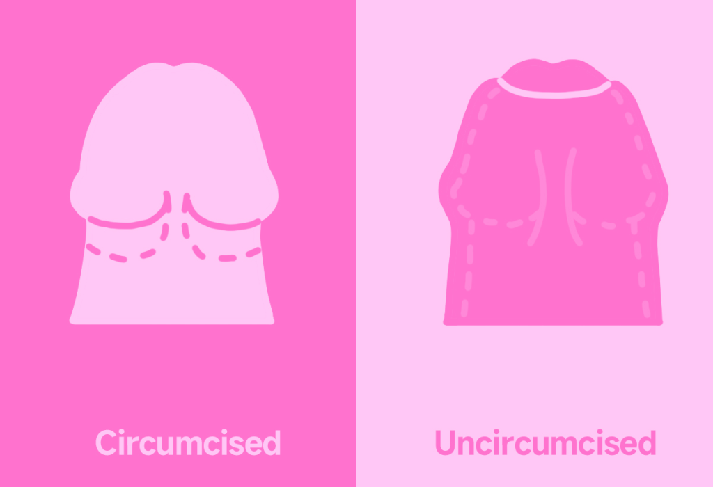 circumcised penis